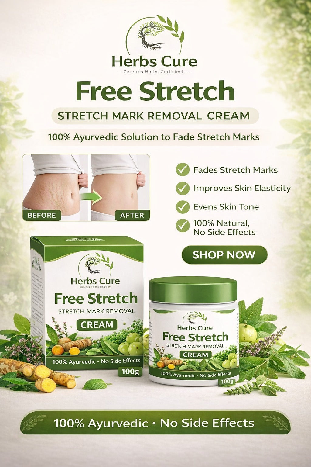 Stretch mark cream